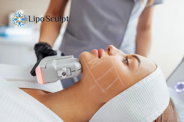 HIFU vs Botulinum Toxin: Understanding the Differences 1 HIFU vs Botox Stanley What is the best option for you?