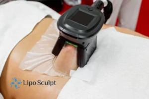 Are The Results From Aqualyx Permanent? 4 Compare Aqualyx Stanley to other fat reduction treatments.