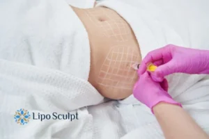 Are The Results From Aqualyx Permanent? 1 Do you want to know how long Aqualyx Stanley results last?
