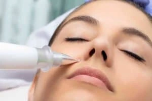 Best Actinic Keratoses Removal 3 Actinic keratoses Stanley solutions - book in today!